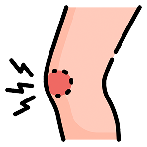 Chronic Inflammation