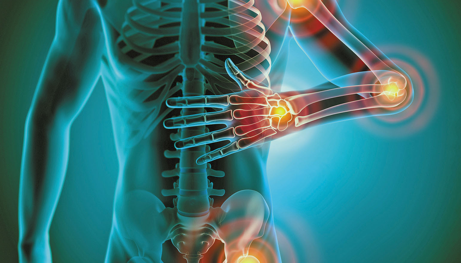 Chronic Inflammation