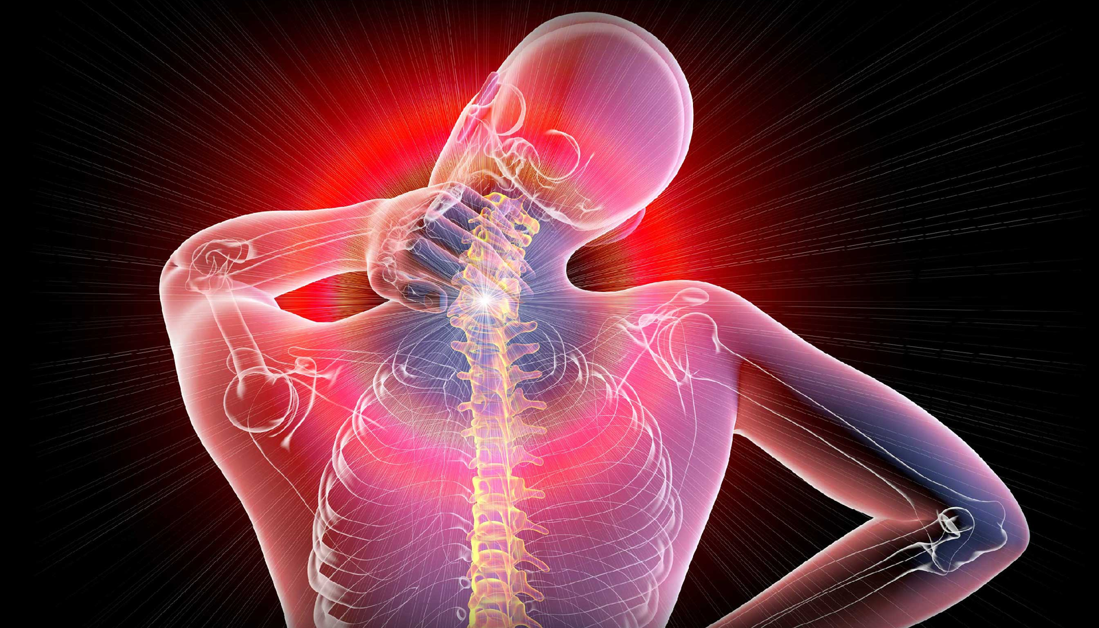 Fibromyalgia Syndrome