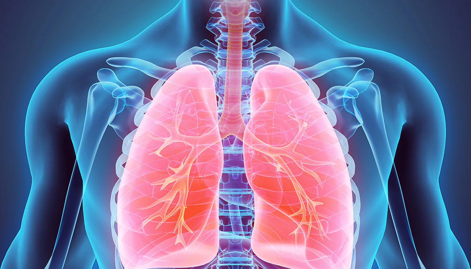 Asthma