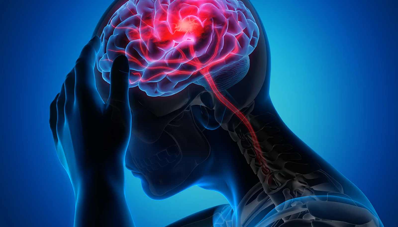 Stroke